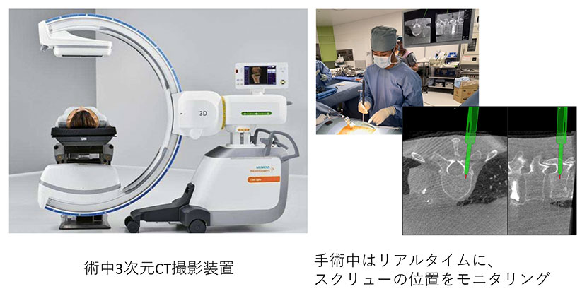 CTを用いたナビゲーション手術